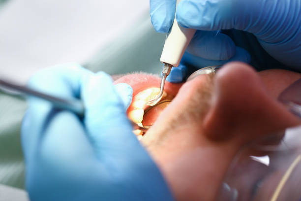 Best Urgent Dental Care for Toothache in Parshall, ND