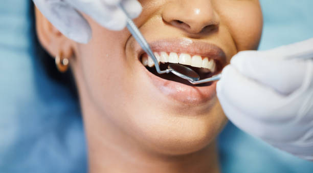 Best Emergency Dental Care for Abscessed Tooth in Parshall, ND